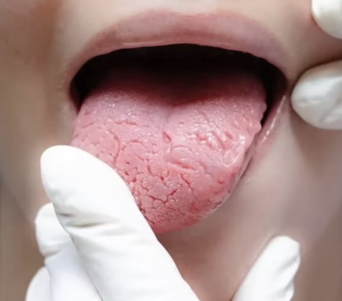 Яка найвірогідніша причина неприємного запаху із рота: і це не шлунок - фото 2