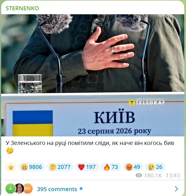 ”Якобы кого-то избил”: на новых фото Зеленского заметили странные следы на руках (ФОТО) - фото 2