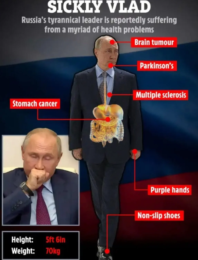 У Путіна знайшли симптоми нової смертельної хвороби: що зі здоров'ям очільника Кремля - фото 2