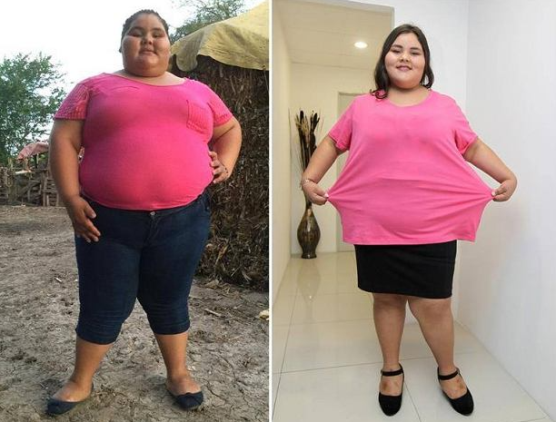 Девушка похудела на 100 килограммов: она изменилась до неузнаваемости (ФОТО) - фото 2